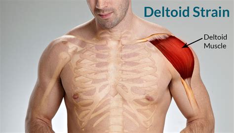 side deltoid tear test|shoulder pain in deltoid area.